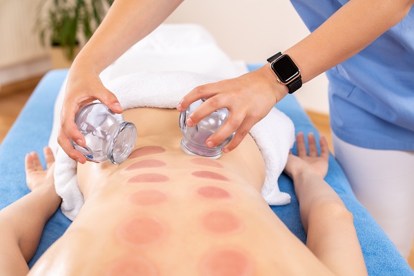 https://www.scsportstherapy.com/wp-content/uploads/Cupping-2207.jpg