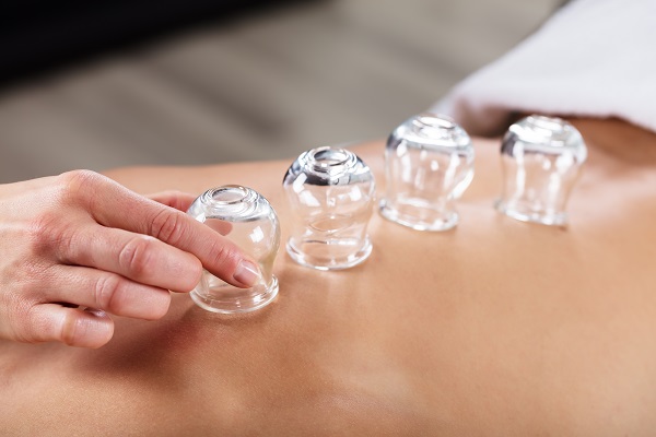 Cupping Therapy Best Practices: Uses, Benefits & More
